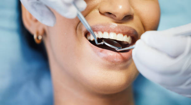 Best Dental Abscess Treatment in Sullivans Island, SC